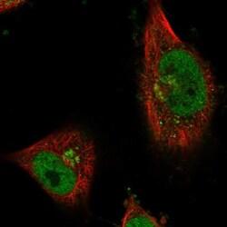 CWF19L1 Antibody, Novus Biologicals 0.1mL; Unlabeled:Antibodies, Polyclonal
